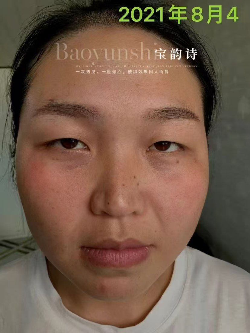 保养3年前后的差距，
不比不知道一比吓一跳
你觉得这样的效果怎么样？