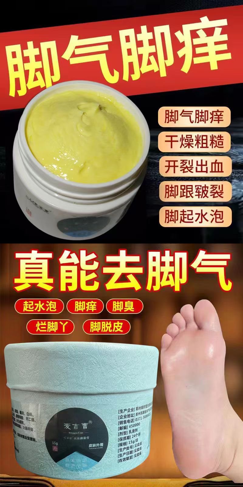 脚气膏，解决你的大问题，瘙痒难耐，手足癣，蚊虫叮咬，湿疹都可以抹，并且效果可好，热卖五年[玫瑰]活动