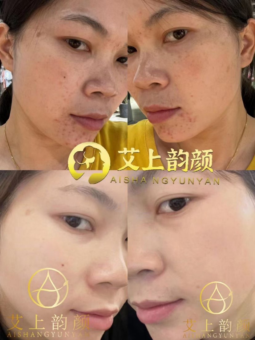 艾上韵颜皮肤敏感，泛红，角质层薄，孕妇都能用，国妆特字安全有效，水润不拔干🌹