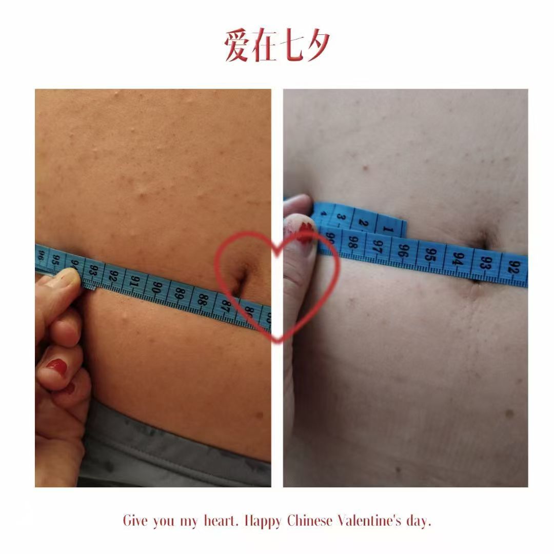 用事实说话
  效果杆杆的

大肚子👀过来
两瓶姜祖下去小了4cm